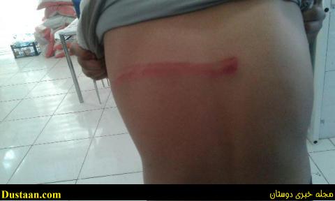 www.dustaan.com-تصاویر: کتک زدن وحشیانه دانش آموز قائنی توسط معلم