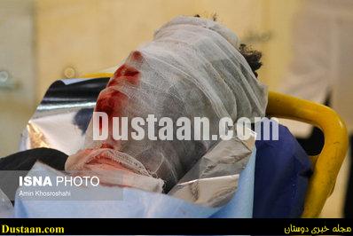 www.dustaan.com-dustaan.com-تصاویری دردناک از مصدومان چهارشنبه سوری ! 