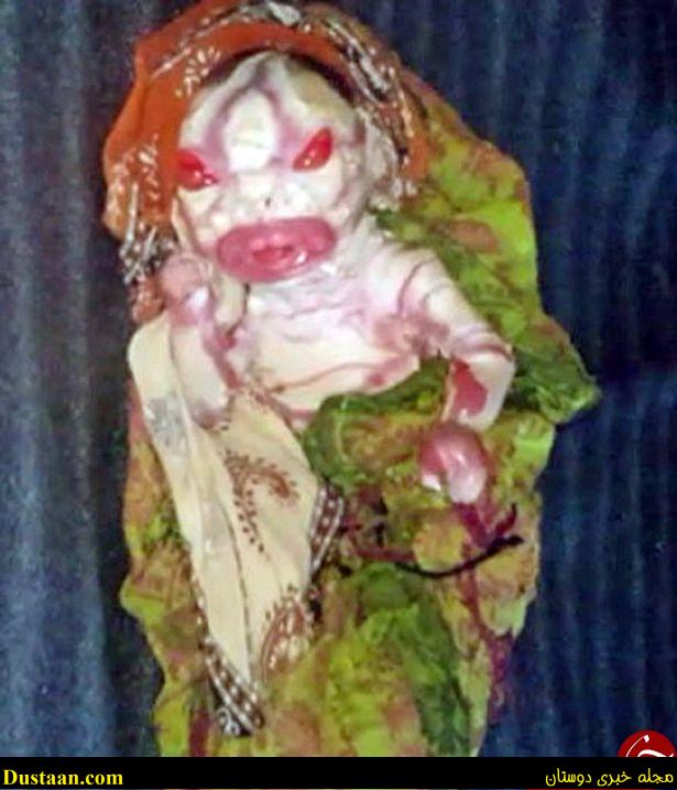 www.dustaan.com-تولد نوزاد نفرین‌ شده با قیافه ای ترسناک در هندوستان + تصاویر