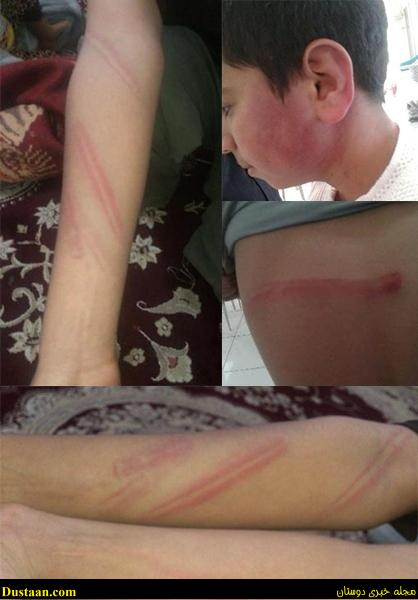 www.dustaan.com-تصاویر: کتک زدن وحشیانه دانش آموز قائنی توسط معلم