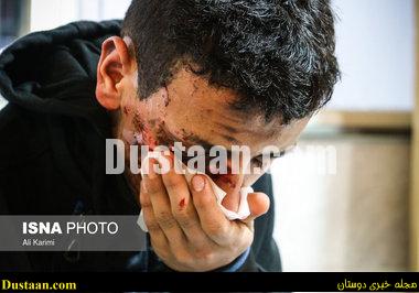 www.dustaan.com-dustaan.com-تصاویری دردناک از مصدومان چهارشنبه سوری ! 