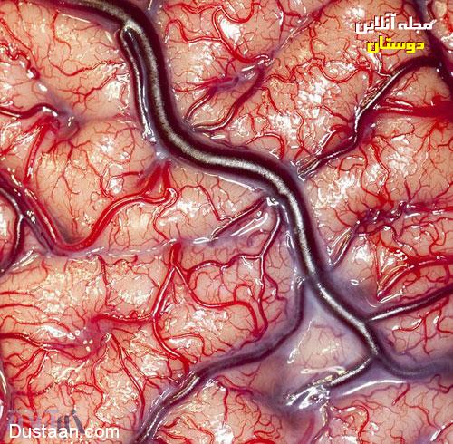 عکسی خارق العاده از مغز زنده انسان