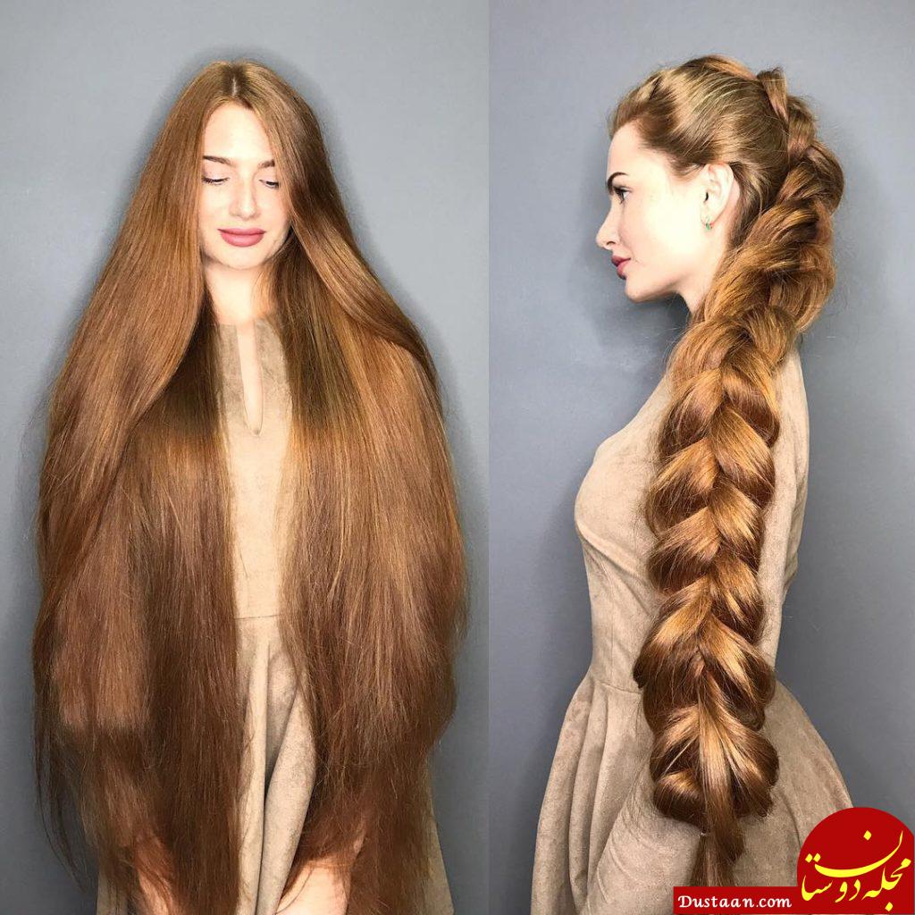 http://www.viraltrendzz.com/wp-content/uploads/2017/11/Model-hair-loss-anastasia-sidorova_9.jpg