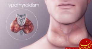 https://www.blog.drvikram.com/wp-content/uploads/2019/01/What-is-Hypothyroidism.jpeg