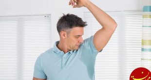 https://kohanteb.ir/wp-content/uploads/2018/12/Hyperhidrosis-excessive-sweating.jpg