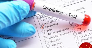 https://cdn1.medicalnewstoday.com/content/images/articles/322/322380/creatinine-blood-test.jpg